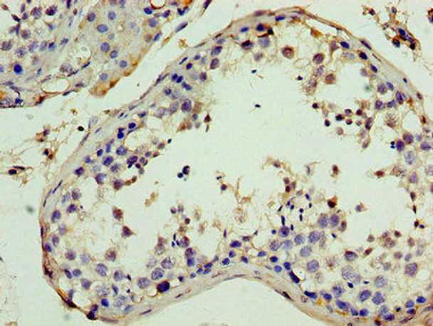 ITIH4 Antibody (PACO27701)