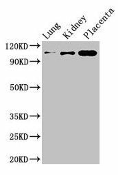 MSH4 Antibody (PACO28398)