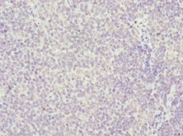 HMGB1 Antibody (PACO28638)