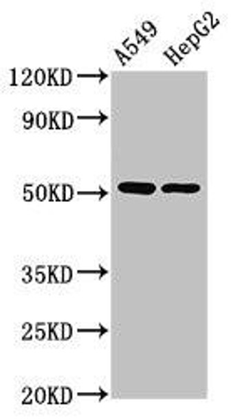 PPOX Antibody (PACO29124)