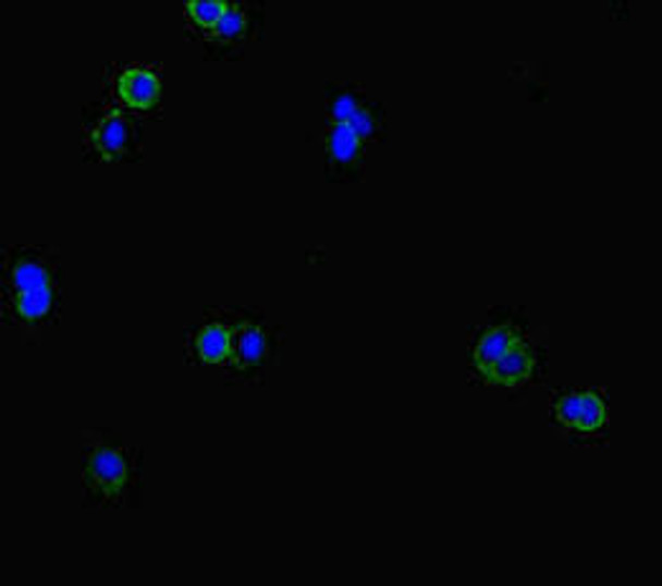 CLCN1 Antibody (PACO45746)