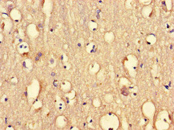 PRMT5 Antibody (PACO46134)