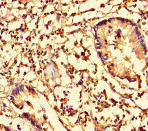 CFL1 Antibody (PACO46354)