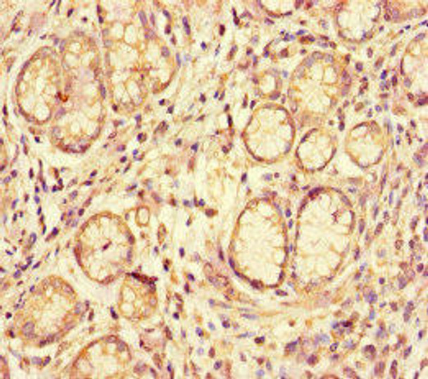 ACE2 Antibody (PACO47046)