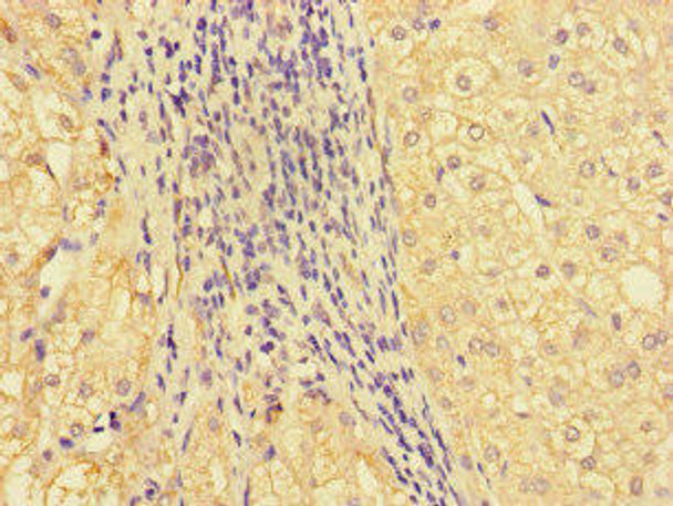 GBA2 Antibody (PACO47146)