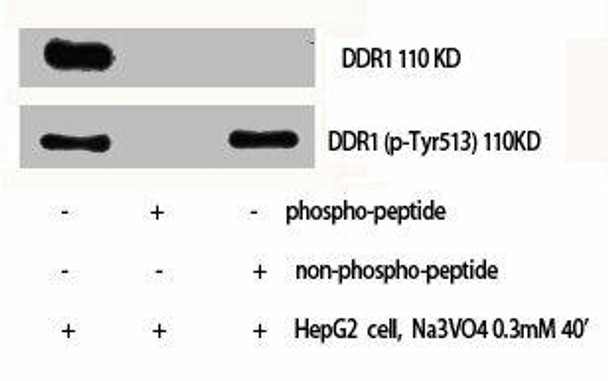 Phospho-DDR1 (Y513) Antibody (PACO00314)