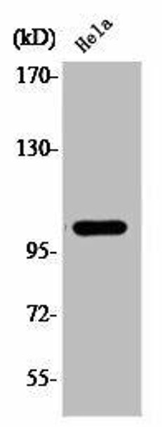 Phospho-NFKB1 (S927) Antibody (PACO00320)