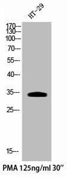 Phospho-CDK5 (Y15) Antibody (PACO02304)