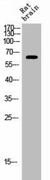 Phospho-ESR1 (S106) Antibody (PACO02672)