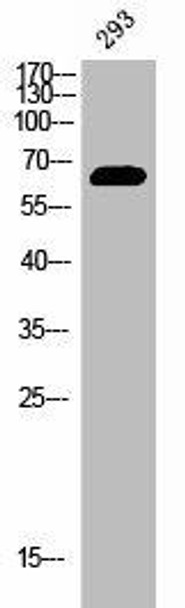 Phospho-ESR1 (Y537) Antibody (PACO02673)