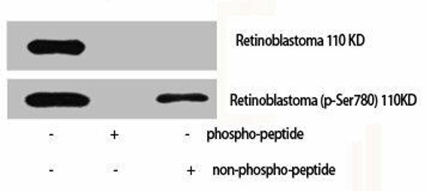 Phospho-RB1 (S780) Antibody (PACO06150)