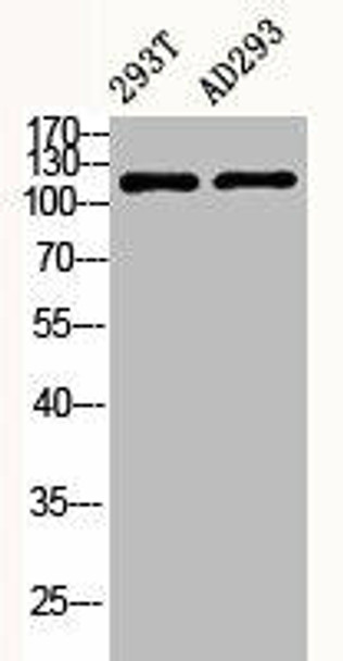 Phospho-PTK2 (Y397) Antibody (PACO06184)