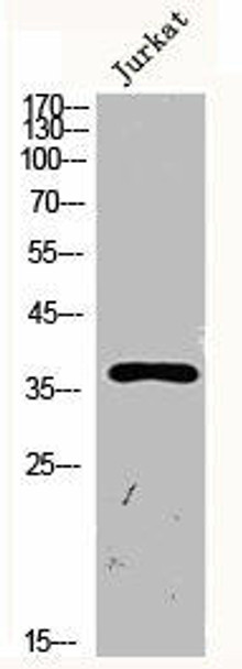 SERPINE1 Antibody (PACO06734)