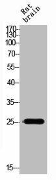 PROCR Antibody (PACO06872)