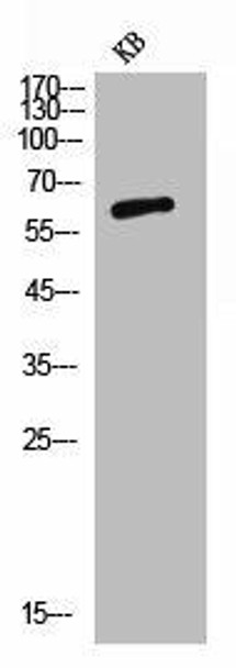 PVRL1 Antibody (PACO06896)