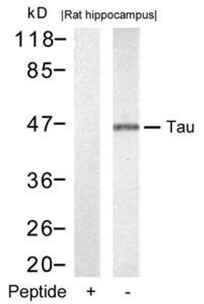 MAPT (Ab-212) Antibody (PACO21405)