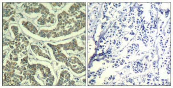 ATR (Ab-428) Antibody (PACO21427)