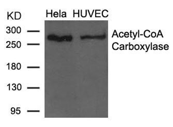 ACACA (Ab-79) Antibody (PACO21567)