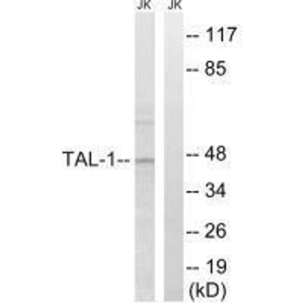 TAL1 (Ab-122) Antibody (PACO21631)