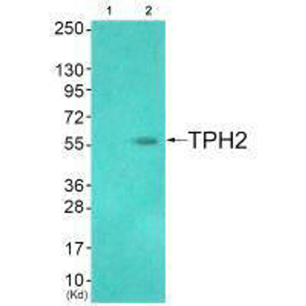 TPH2 (Ab-19) Antibody (PACO21638)