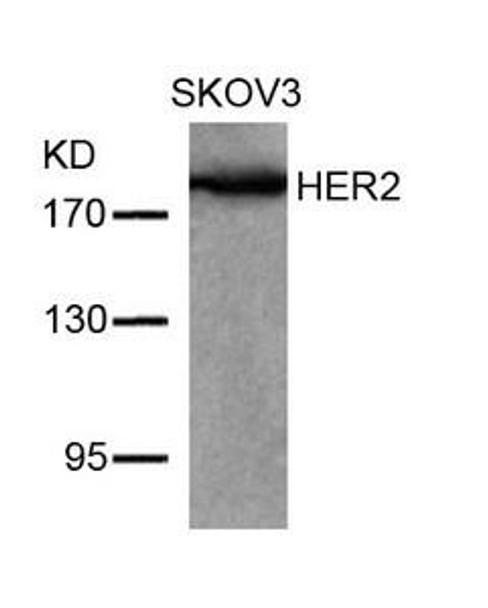 ERBB2 (Ab-877) Antibody (PACO22898)