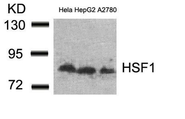 HSF1 (Ab-307) Antibody (PACO22950)