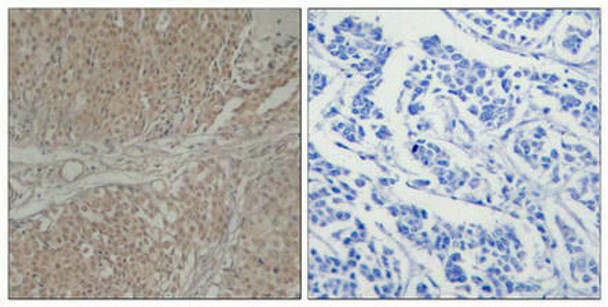 SMAD3 (Ab-208) Antibody (PACO22984)