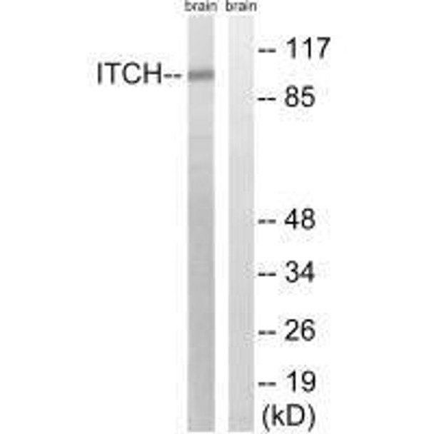 ITCH (Ab-420) Antibody (PACO23072)