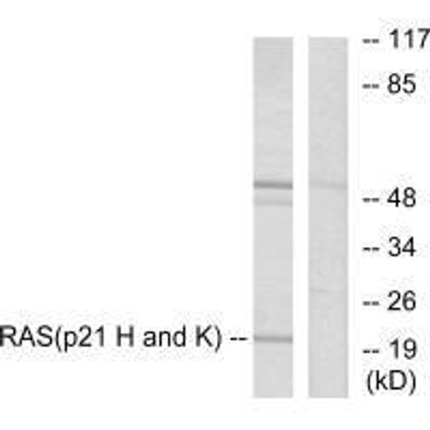 RASH/RASK/RASN Antibody (PACO23134)