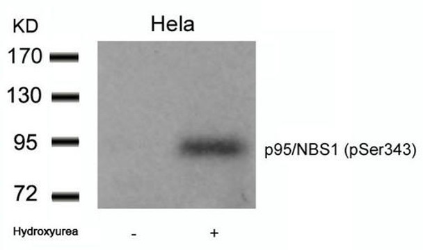 Phospho-NBN (Ser343) Antibody (PACO23846)