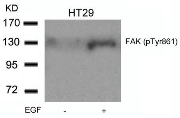 Phospho-PTK2 (Tyr861) Antibody (PACO23848)
