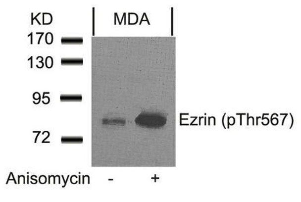 Phospho-EZR (Thr567) Antibody (PACO23866)
