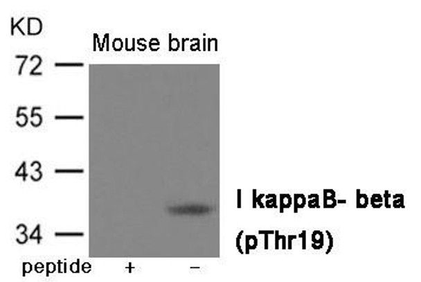 Phospho-NFKBIB (Thr19) Antibody (PACO23934)