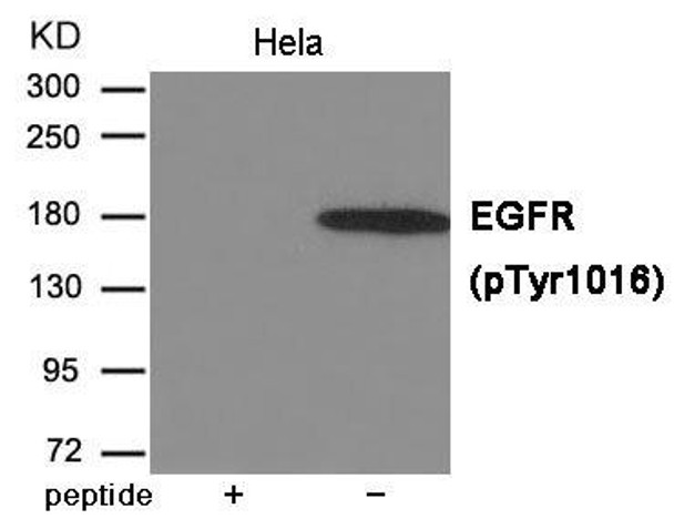 Phospho-EGFR (Tyr1016) Antibody (PACO23935)