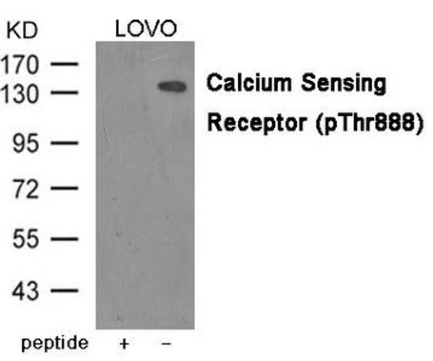 Phospho-CASR (Thr888) Antibody (PACO23958)