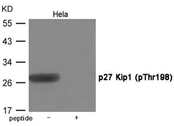 Phospho-CDKN1B (Thr198) Antibody (PACO23964)