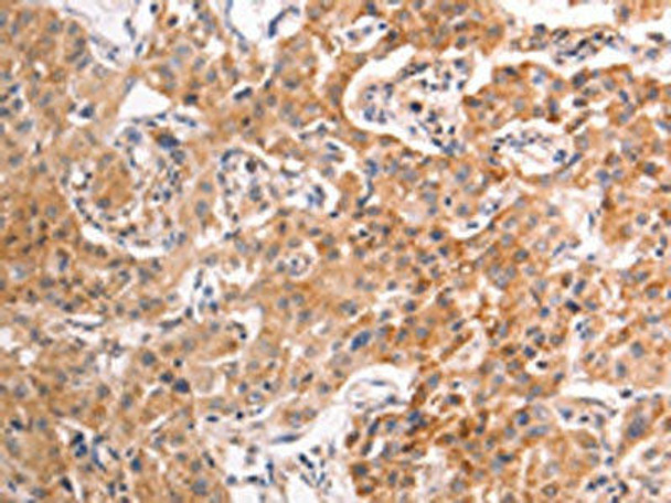 TRPV4 Antibody (PACO15157)