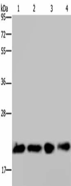 HRAS Antibody (PACO17567)