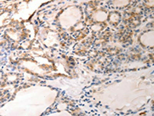 VTCN1 Antibody (PACO17625)