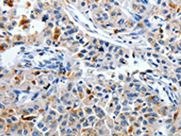 CDK3 Antibody (PACO17680)