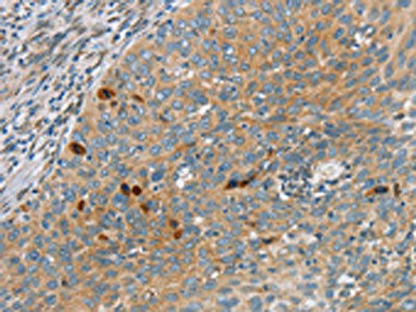 SFRP5 Antibody (PACO17826)