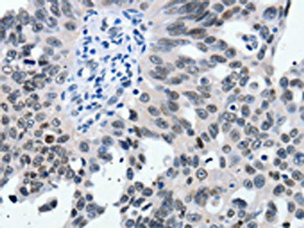 SUMO1 Antibody (PACO17923)