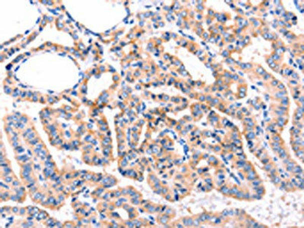 ADRBK1 Antibody (PACO18036)