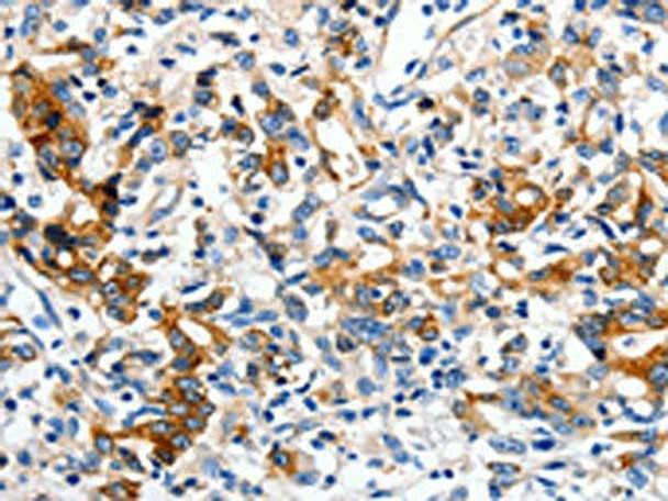 LRP1 Antibody (PACO18167)