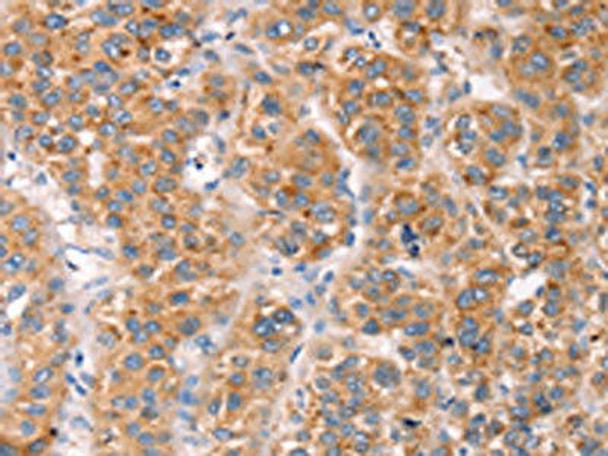 MLNR Antibody (PACO18253)
