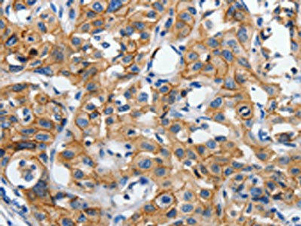 CDH1 Antibody (PACO18275)