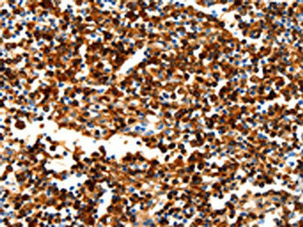 NCOR1 Antibody (PACO18283)