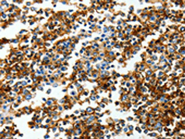 GRIA3 Antibody (PACO18313)