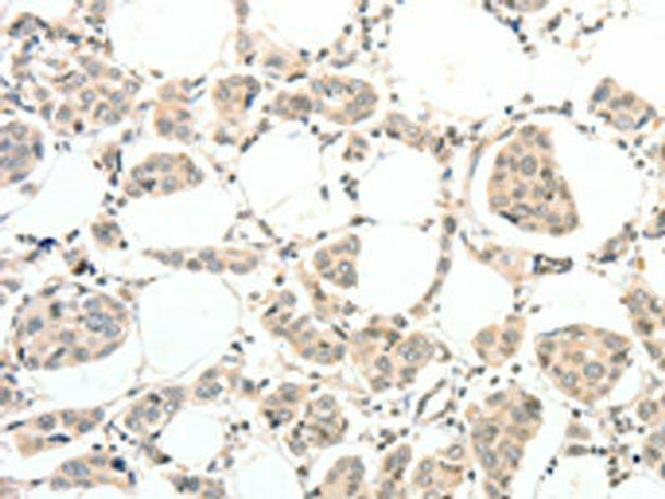 TSPYL2 Antibody (PACO19475)