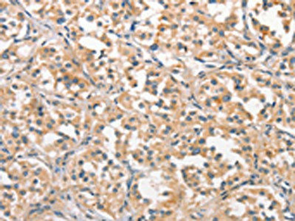 CRIM1 Antibody (PACO19512)